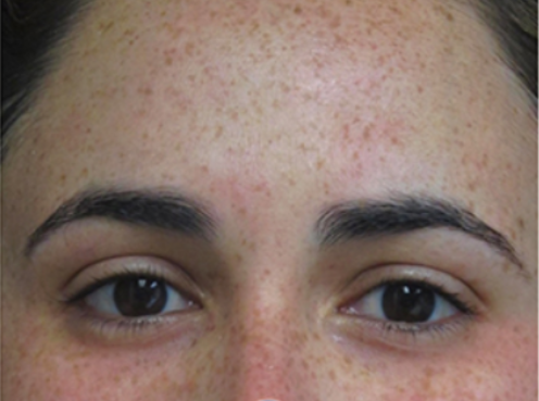 image comparison before